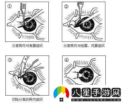 獲得超級胬肉系統(tǒng)怎么辦