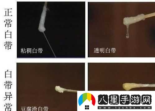 白色液體流出且睡不著咋回事